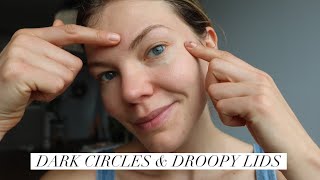 Droopy Eyelids amp Dark Circles Massage [upl. by Usanis]