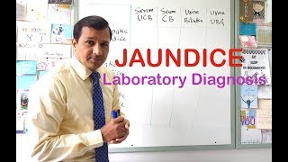 Jaundice  Laboratory Diagnosis [upl. by Patty]