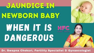 Jaundice In New Born Babies  Symptoms amp Treatment  Dr Swapna Chekuri  HFC [upl. by Eleph]