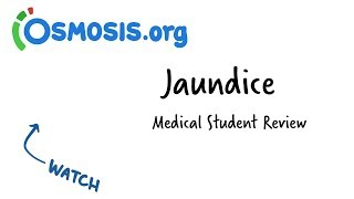 Jaundice  Clinical Presentation [upl. by Enasus821]