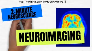 How Does an MRI Scan Work [upl. by Trojan270]