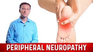 How to Relieve Peripheral Neuropathy Pain – Dr Berg [upl. by Nawor]