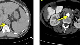 Introduction to Radiology Conventional Radiography [upl. by Nodnal]