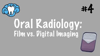 How To Interpret Side Imaging Sonar [upl. by Eloken]