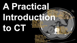 How Functional Ultrasound Works [upl. by Assehc]