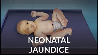 Neonatal Jaundice by L Veit  OPENPediatrics [upl. by Rad]