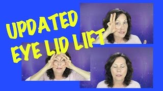 How To Treat Droopy Eyelids or Ptosis Naturally [upl. by Ednarb]